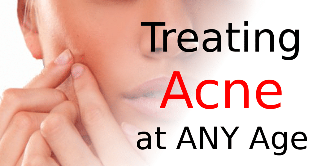 Treating Acne at Any Age