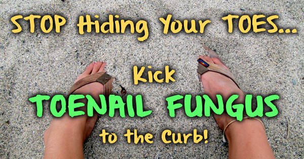 Kick Toenail Fungus to the Curb!