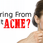 Suffering From Adult Acne?